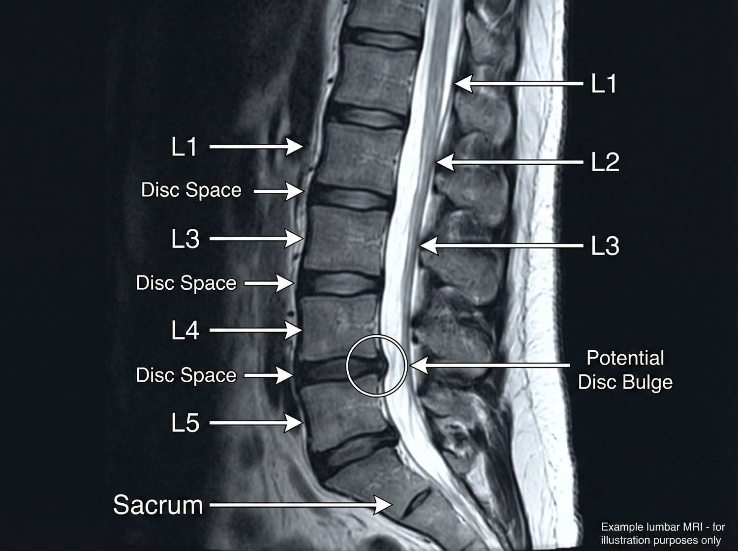 Understanding the Lumbar Spine: Anatomy and Injury Mechanics - illustration 2